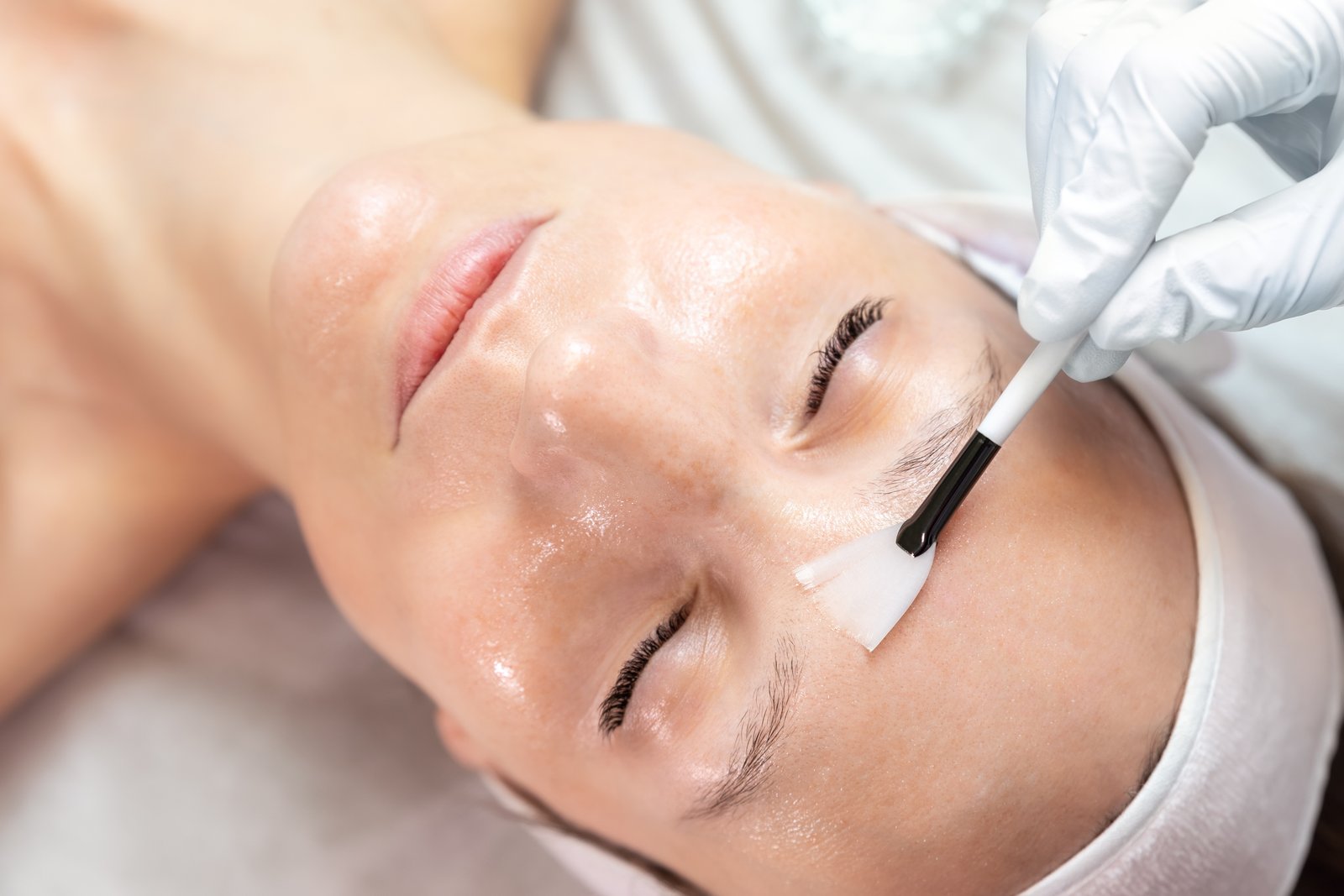Customized Chemical Peel
