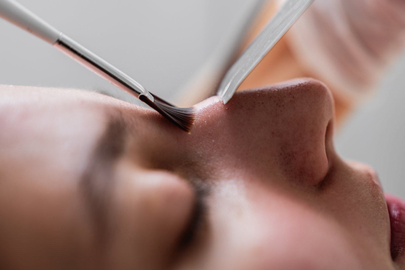 Dermaplaning + Custom Chemical Peel